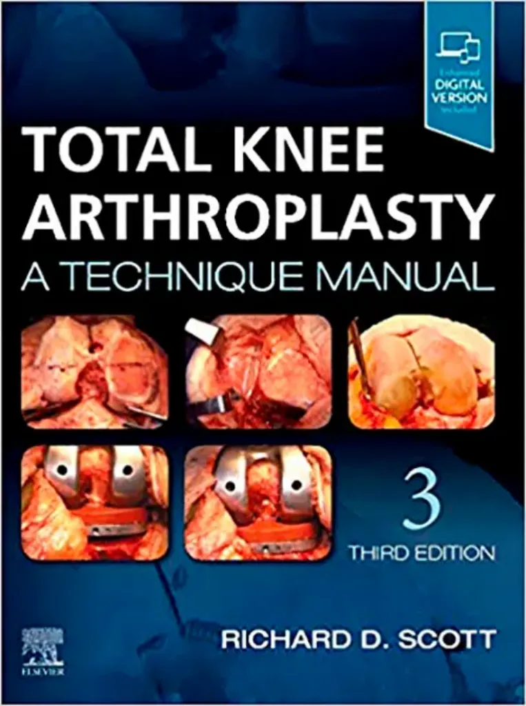 Imagem de Total Knee Arthroplasty: A Technique Manual