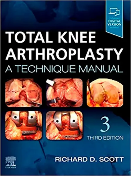 Imagem de Total Knee Arthroplasty: A Technique Manual
