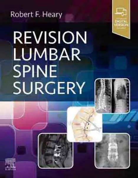 Imagem de Revision Lumbar Spine Surgery