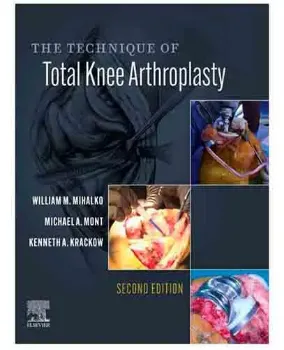 Imagem de The Technique of Total Knee Arthroplasty