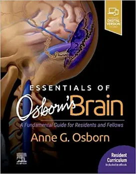 Imagem de Essentials of Osborn's Brain