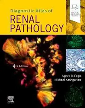 Imagem de Diagnostic Atlas of Renal Pathology