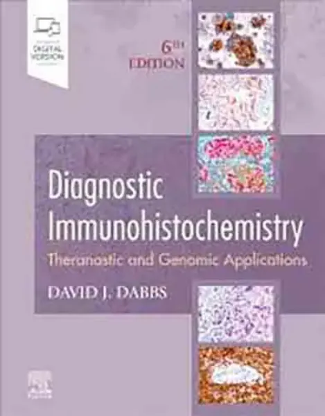 Imagem de Diagnostic Immunohistochemistry: Theranostic and Genomic Applications