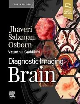 Picture of Book Diagnostic Imaging: Brain