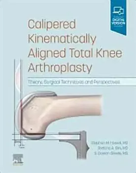 Picture of Book Calipered Kinematically aligned Total Knee Arthroplasty