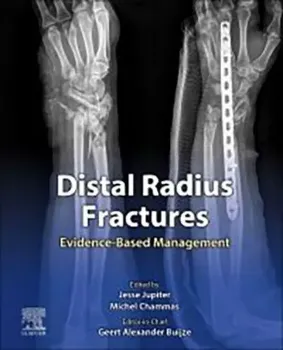 Picture of Book Distal Radius Fractures: Evidence-Based Management
