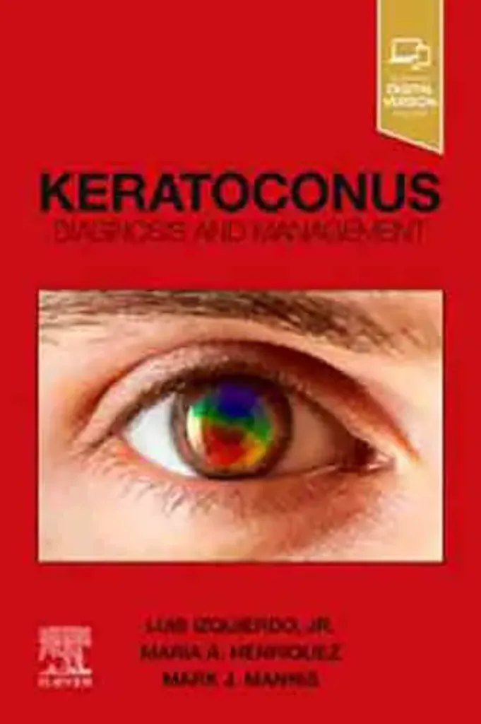 Picture of Book Keratoconus: Diagnosis and Management