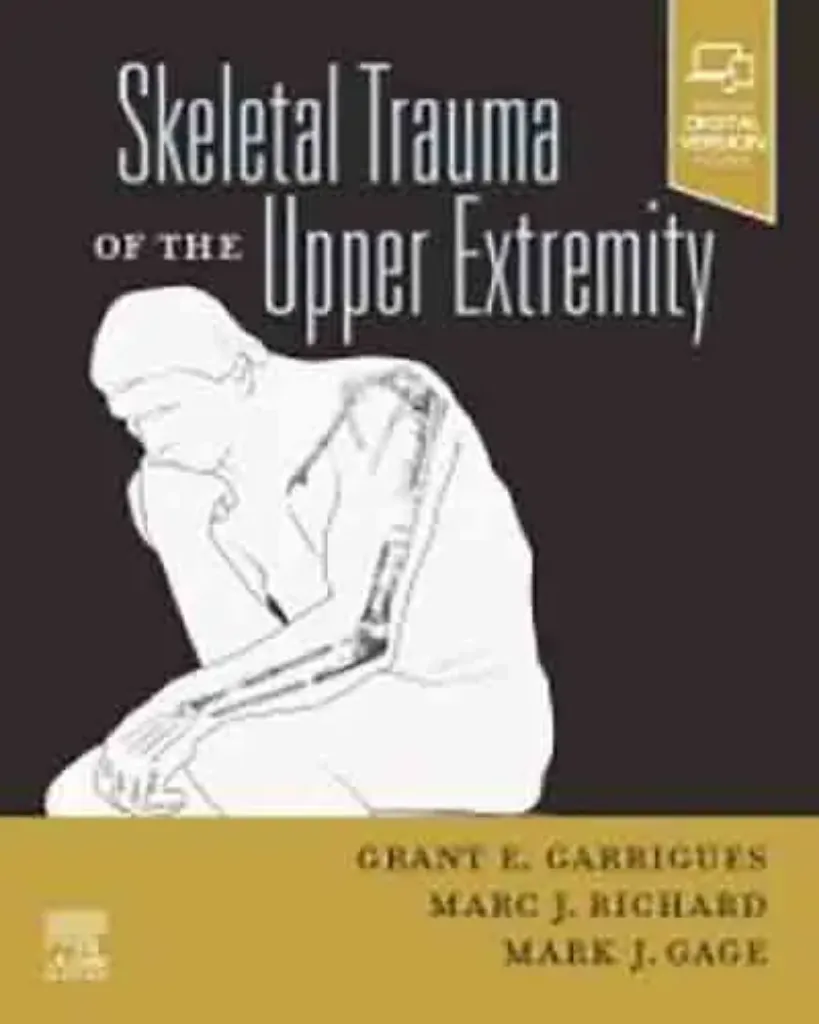 Imagem de Skeletal Trauma of the Upper Extremity