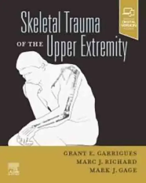 Imagem de Skeletal Trauma of the Upper Extremity