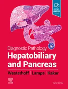 Imagem de Diagnostic Pathology: Hepatobiliary and Pancreas