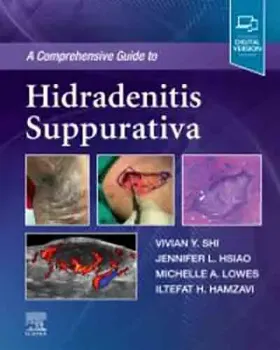Picture of Book A Comprehensive Guide to Hidradenitis Suppurativa
