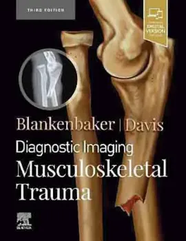 Picture of Book Diagnostic Imaging: Musculoskeletal Trauma
