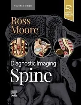 Picture of Book Diagnostic Imaging: Spine