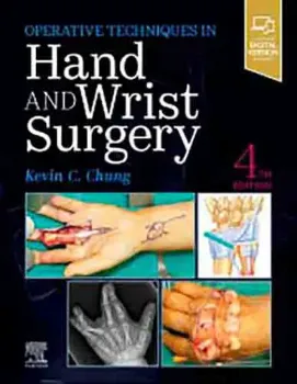 Picture of Book Hand And Wrist Surgery Operative Techniques