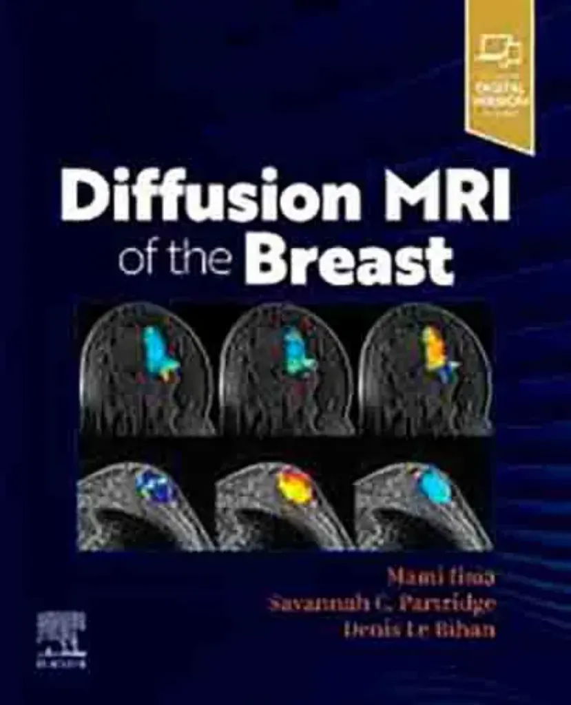 Imagem de Diffusion MRI of the Breast