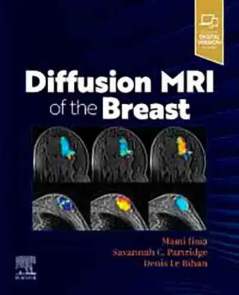 Imagem de Diffusion MRI of the Breast