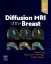 Picture of Book Diffusion MRI of the Breast