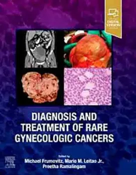 Picture of Book Diagnosis and Treatment of Rare Gynecologic Cancers