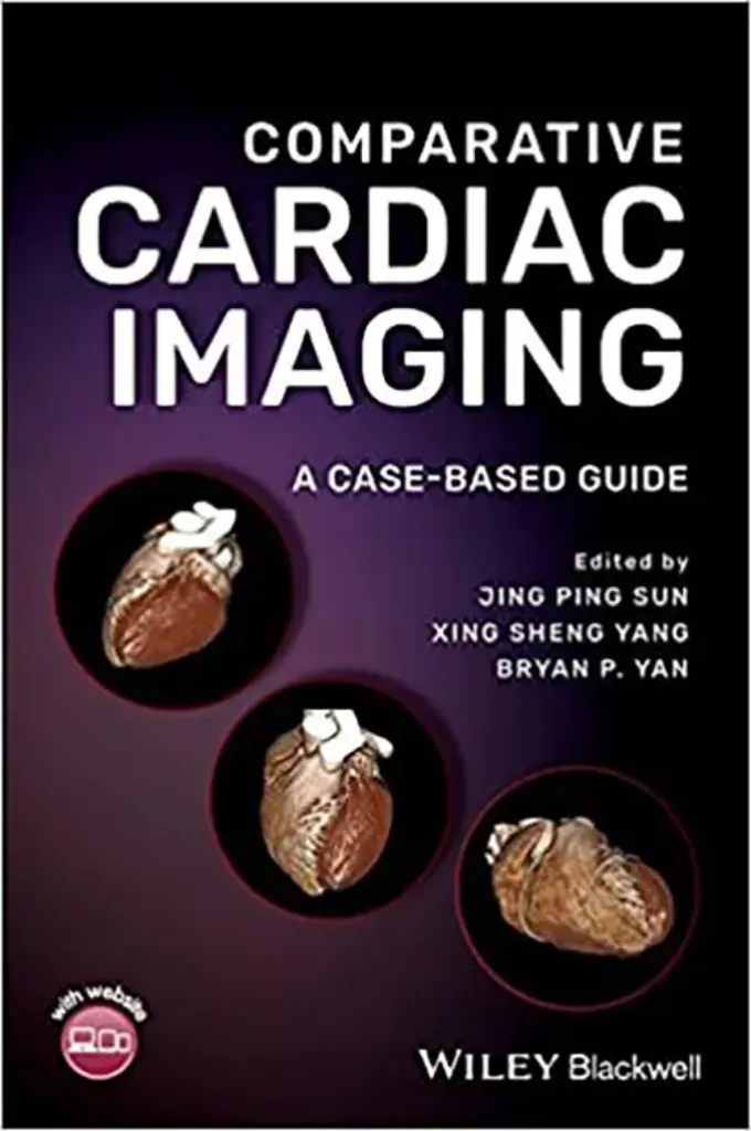 Imagem de Comparative Cardiac Imaging: A Case-based Guide