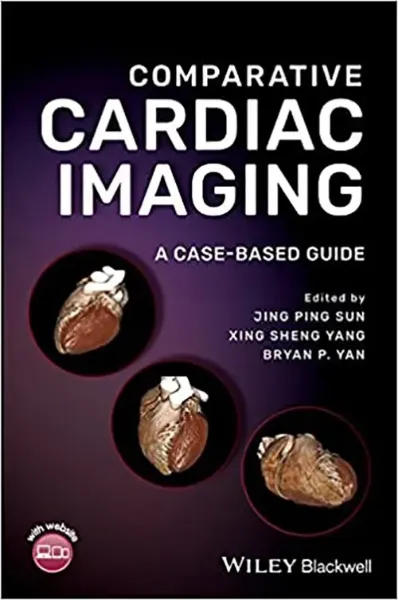 Imagem de Comparative Cardiac Imaging: A Case-based Guide