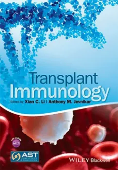 Imagem de Transplant Immunology