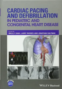 Imagem de Cardiac Pacing and Defibrillation in Pediatric and Congenital Heart Disease