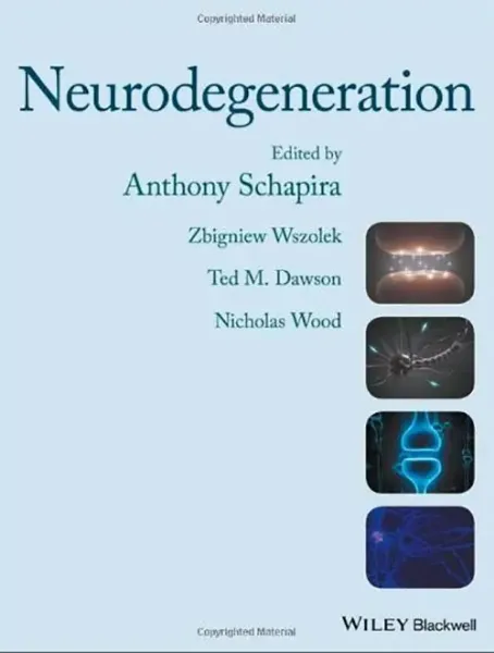 Imagem de Neurodegeneration