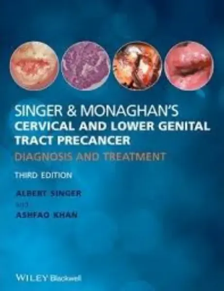 Imagem de Singer and Monaghan's Cervical and Lower Genital Tract Precancer: Diagnosis and Treatment