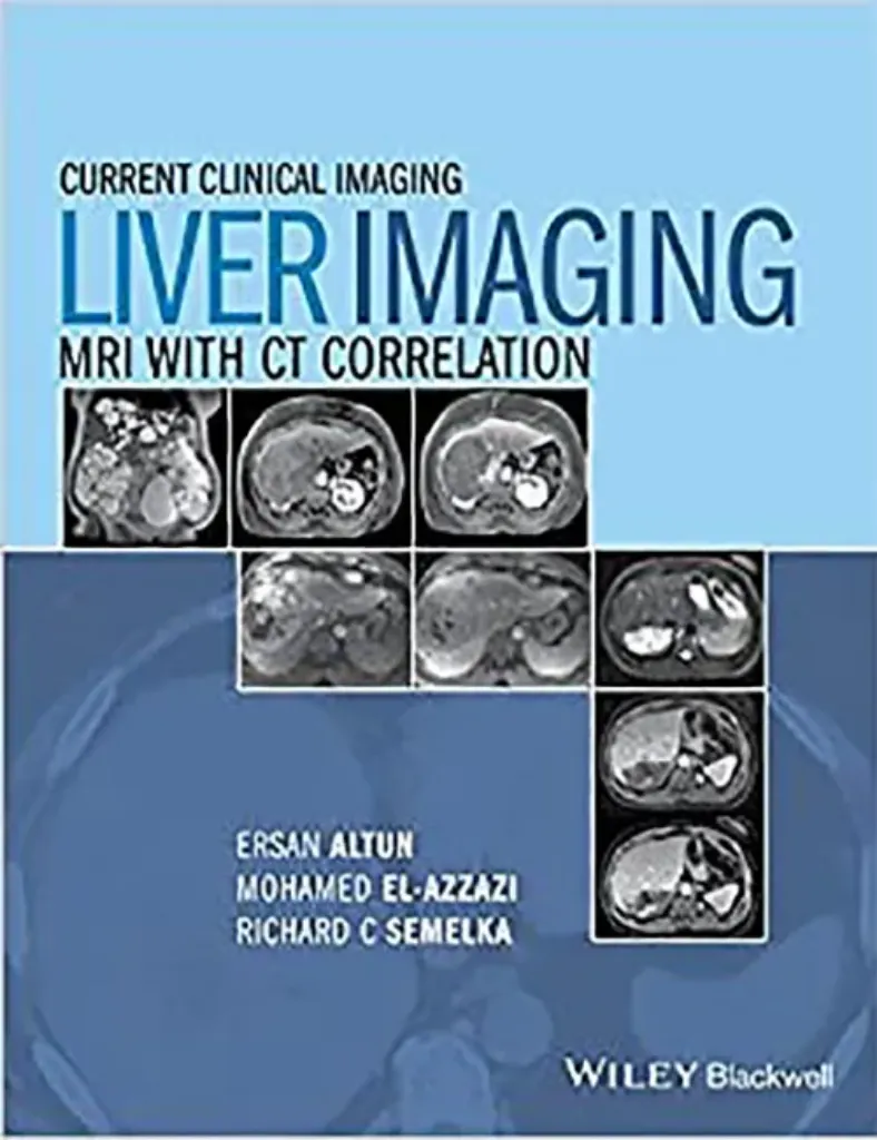 Imagem de Liver Imaging: MRI with CT Correlation