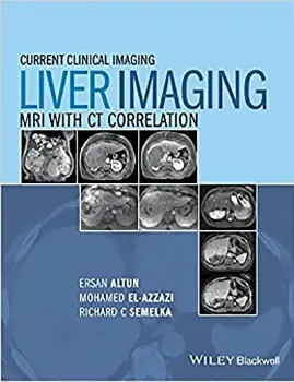 Picture of Book Liver Imaging: MRI with CT Correlation