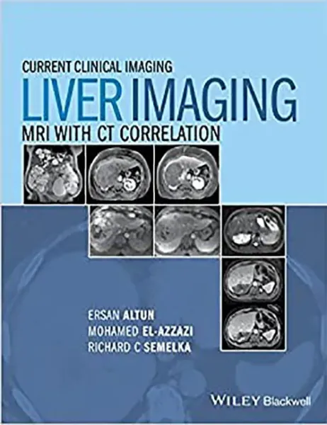 Imagem de Liver Imaging: MRI with CT Correlation