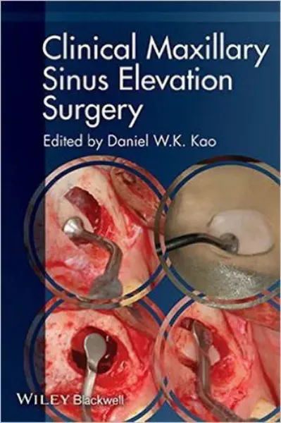 Picture of Book Clinical Maxillary Sinus Elevation Surgery