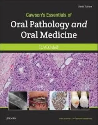 Imagem de Cawson's Essentials of Oral Pathology and Oral Medicine