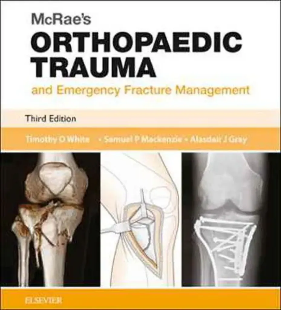 Imagem de Mcrae's Orthopaedic Trauma Emergency Fracture Management