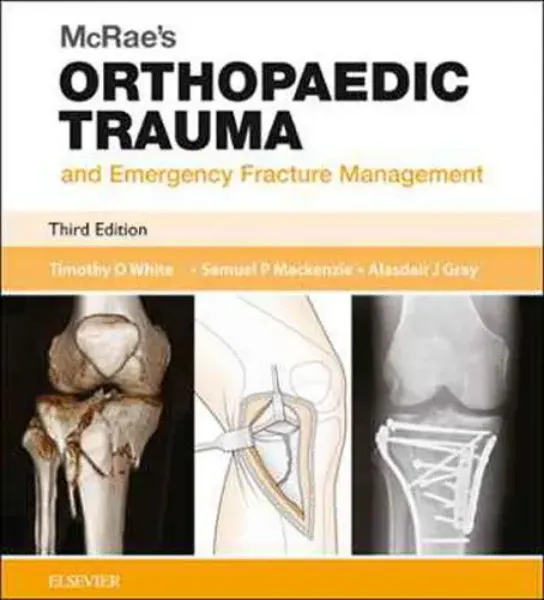 Imagem de Mcrae's Orthopaedic Trauma Emergency Fracture Management