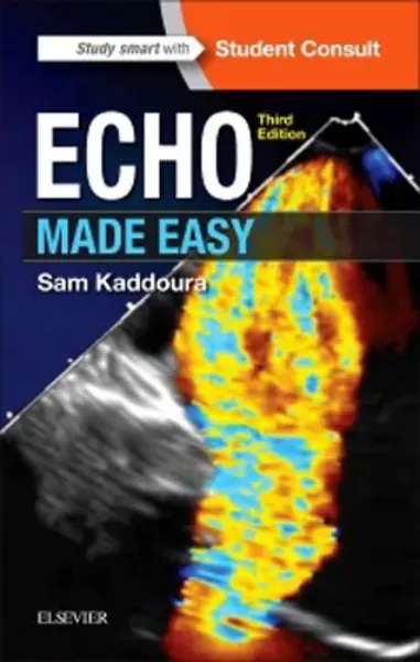 Imagem de Echo Made Easy