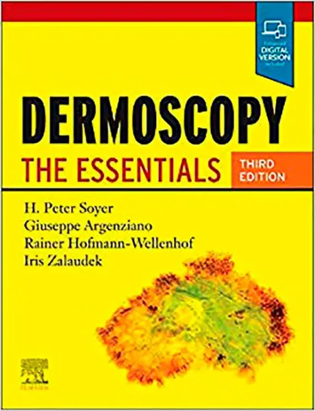 Imagem de Dermoscopy: The Essentials