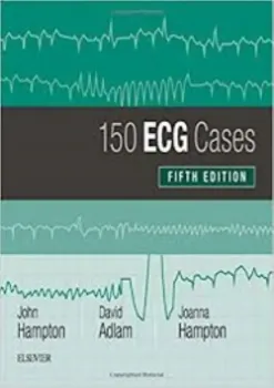 Picture of Book The 150 ECG Cases