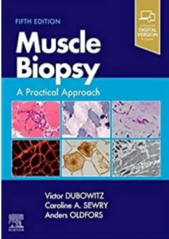 Imagem de Muscle Biopsy: A Practical Approach