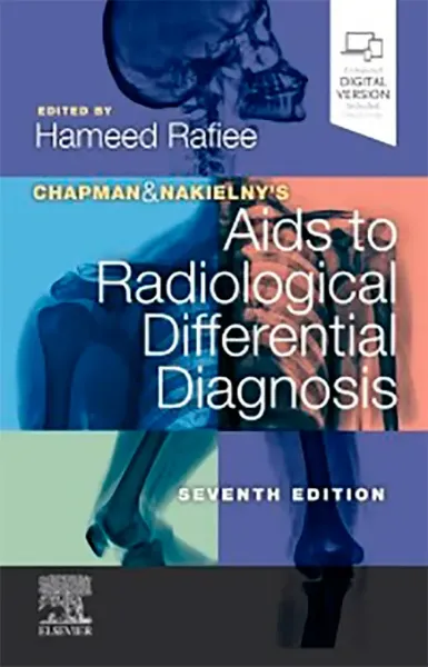 Imagem de Chapman & Nakielny's Aids to Radiological Differential Diagnosis