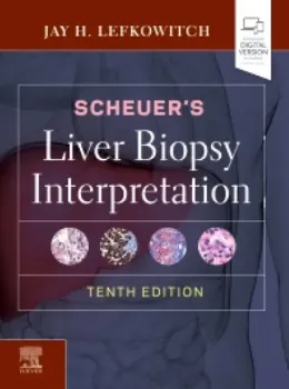 Imagem de Scheuer's Liver Biopsy Interpretation