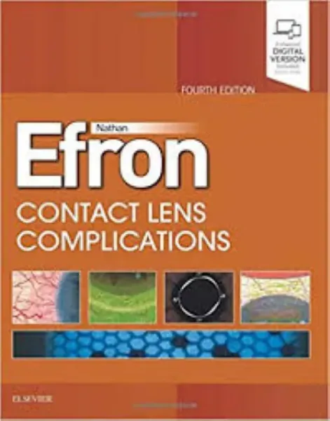 Imagem de Contact Lens Complications