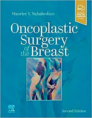 Imagem de Oncoplastic Surgery of the Breast