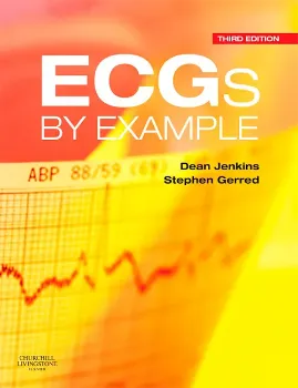 Imagem de ECGs by Example
