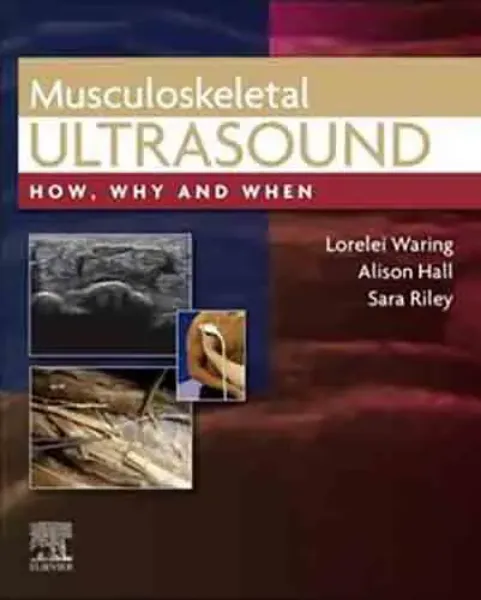 Imagem de Musculoskeletal Ultrasound
