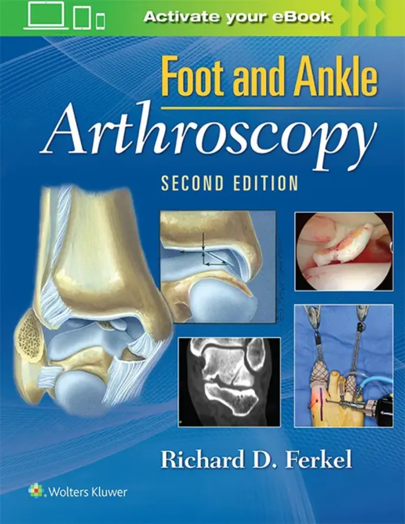 Imagem de Foot & Ankle Arthroscopy