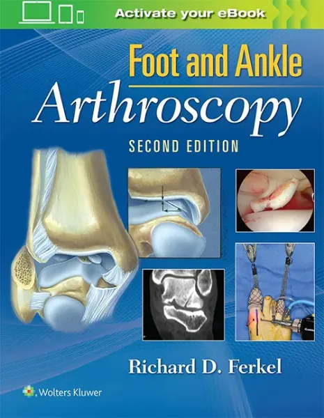 Imagem de Foot & Ankle Arthroscopy