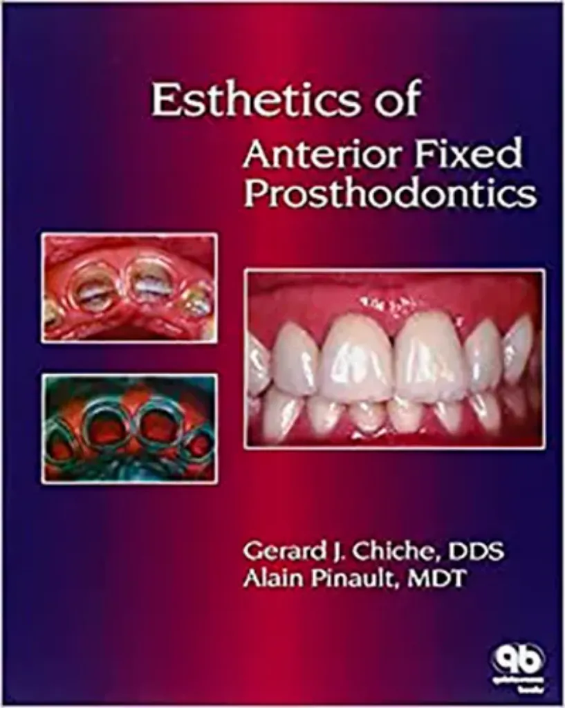 Imagem de Esthetics of Anterior Fixed Prosthodontics