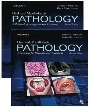 Imagem de Oral and Maxillofacial Pathology: A Rationale for Diagnosis and Treatment