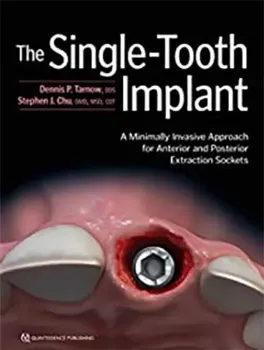 Imagem de The Single-Tooth Implant A Minimally Invasive Approach for Anterior and Posterior Extraction Sockets